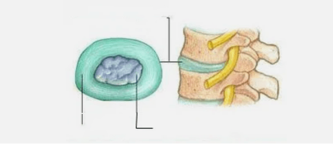 Osteokondrosiaren izaera